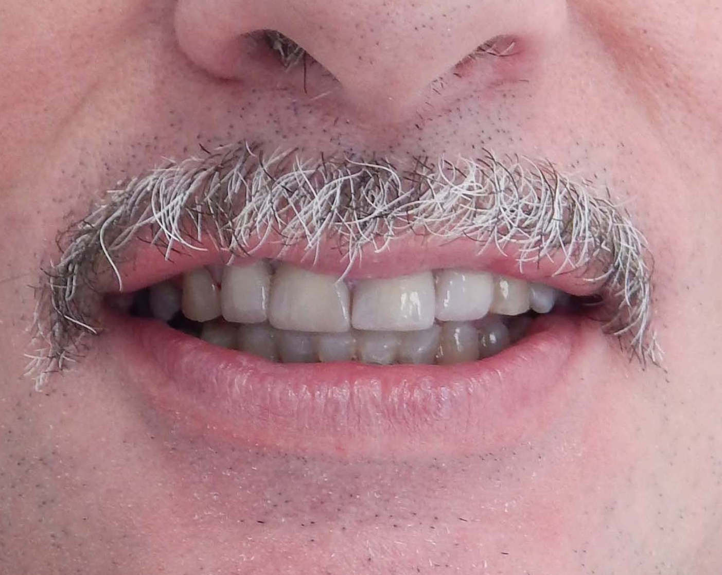 Primo piano di una bocca sorridente con baffi grigi e denti visibili