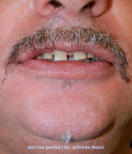 Primo piano di una bocca sorridente con i baffi e gli incisivi visibili, con del testo in basso.