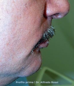 Primo piano di profilo del naso, dei baffi e delle labbra di un uomo su sfondo verde