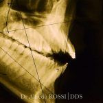 Radiografia dentale dei molari con trattamento canalare visibile, con filigrana del Dr. Marco Rossi DDS