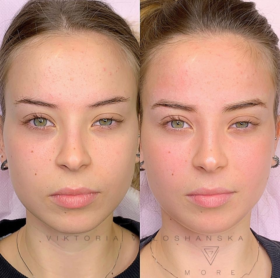 Ritratto affiancato della stessa donna prima e dopo il trucco, espressione neutra.