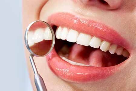 All on 4 dental implants Woodlands, TX