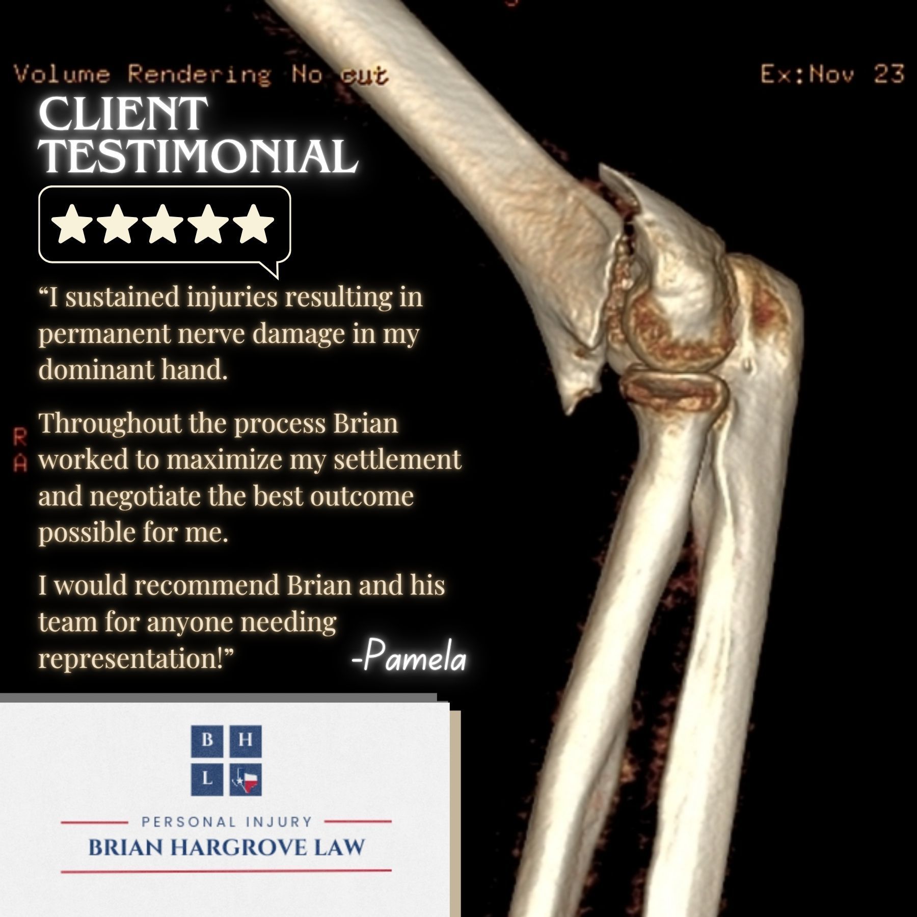 3D Imaging of an arm is displayed behind a five star review from a client who needed multiple surgeries after a car accident. She recommends Brian Hargrove and his team to anyone needing representation.