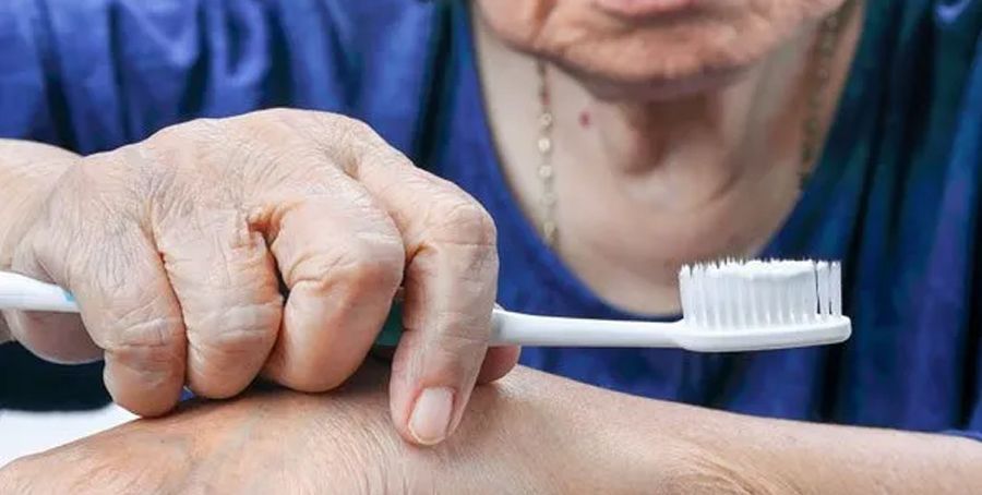 The Link Between Periodontal Disease and Arthritis