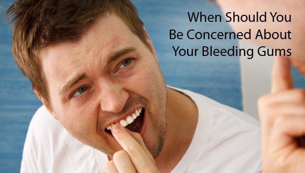 Bleeding Gums, Is it a Big Deal?