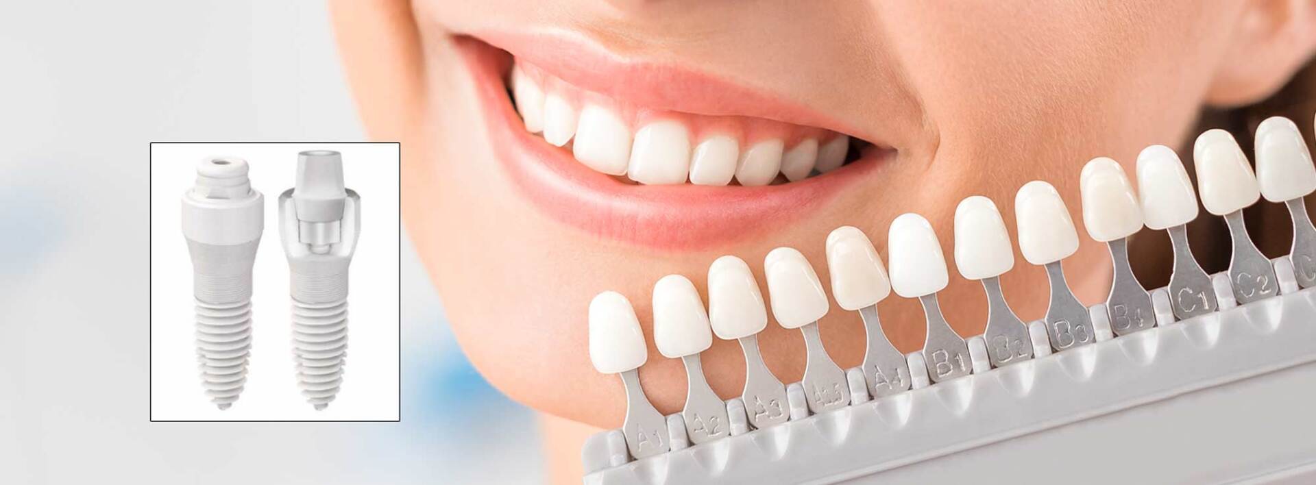 Ceramic Dental Implants Dr. Stephanie Sfiroudis DDS, MS. Ceramic Dental Implant in Nassau County by Dr. Sfiroudis, a Leading Periodontist in Williston Park, NY 11596