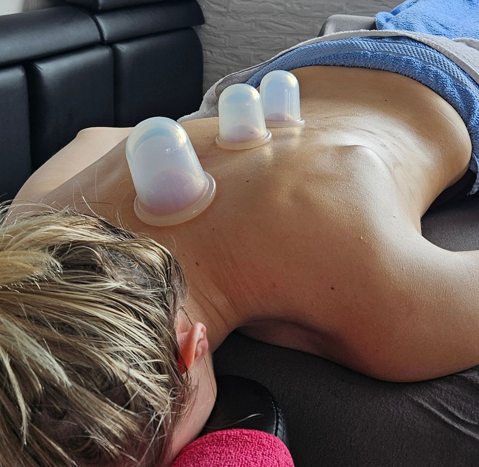 Belde Massagesalon cupping