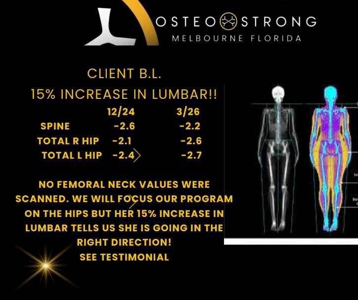 OsteoStrong promo showing client B.L. bone scan results and 15% increase in lumbar BMD from 12/24 to 3/26