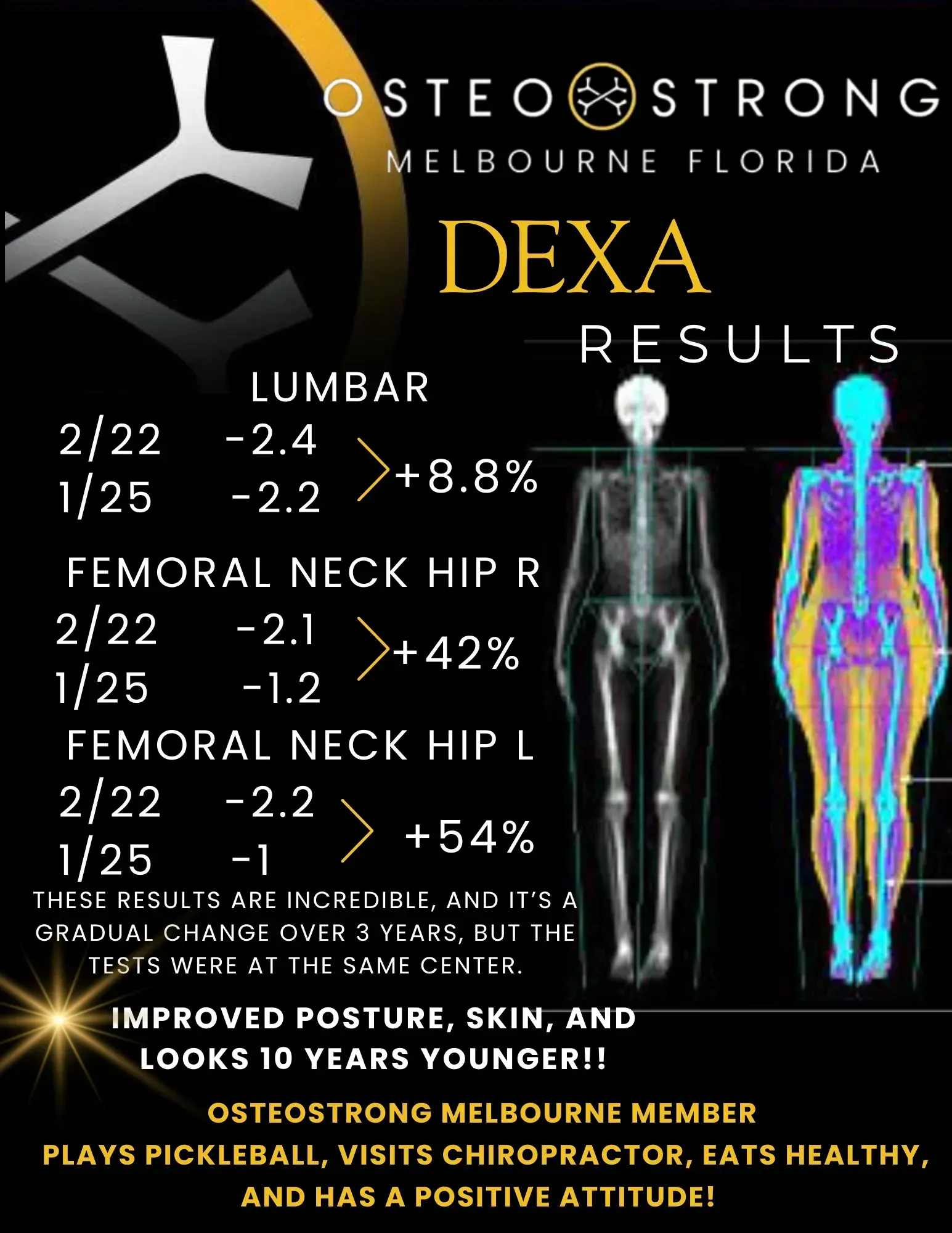 Dexa scan results infographic comparing bone density changes with skeleton body image and text stats.