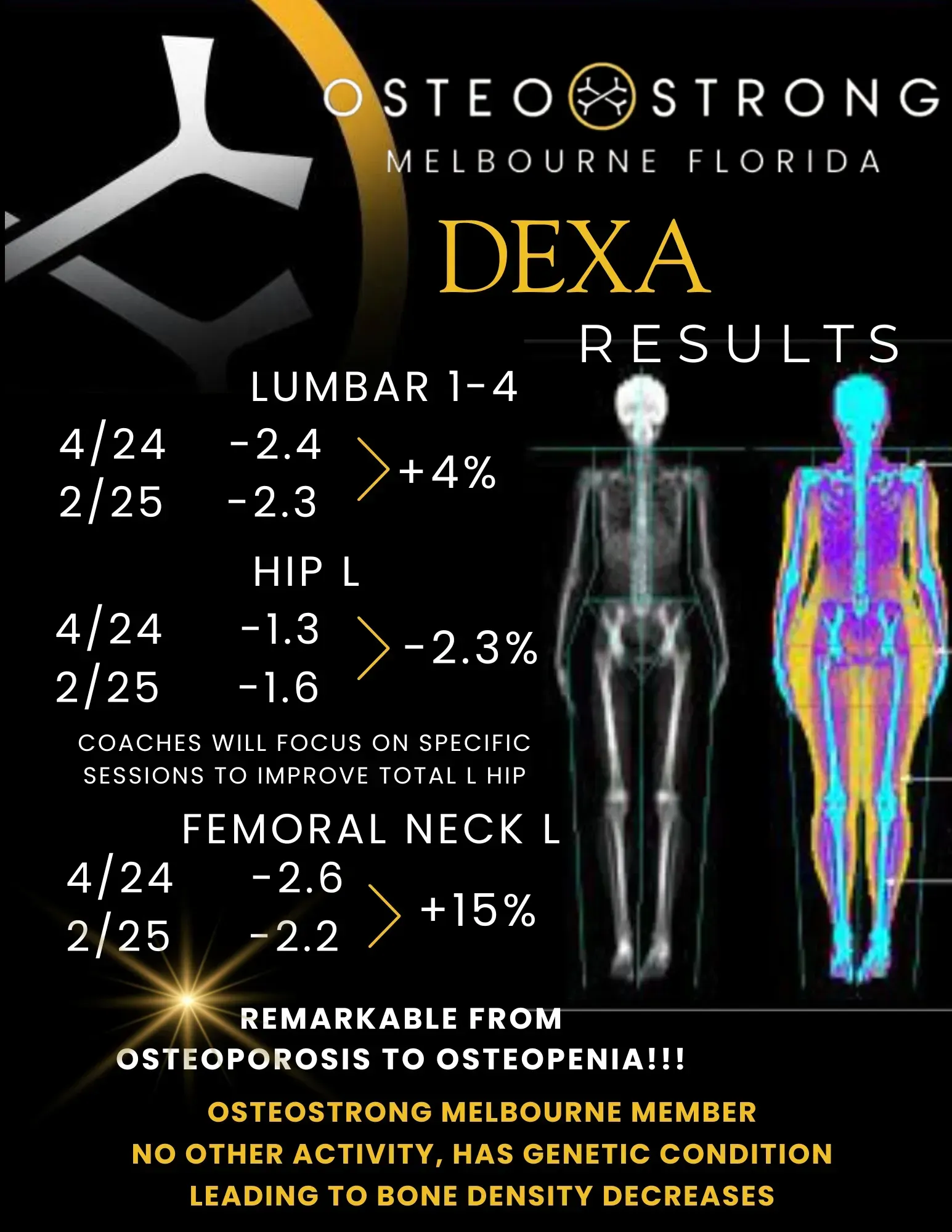 DEXA results infographic with skeleton scans and bone density numbers; lumbar spine, hip, and femoral neck changes shown.