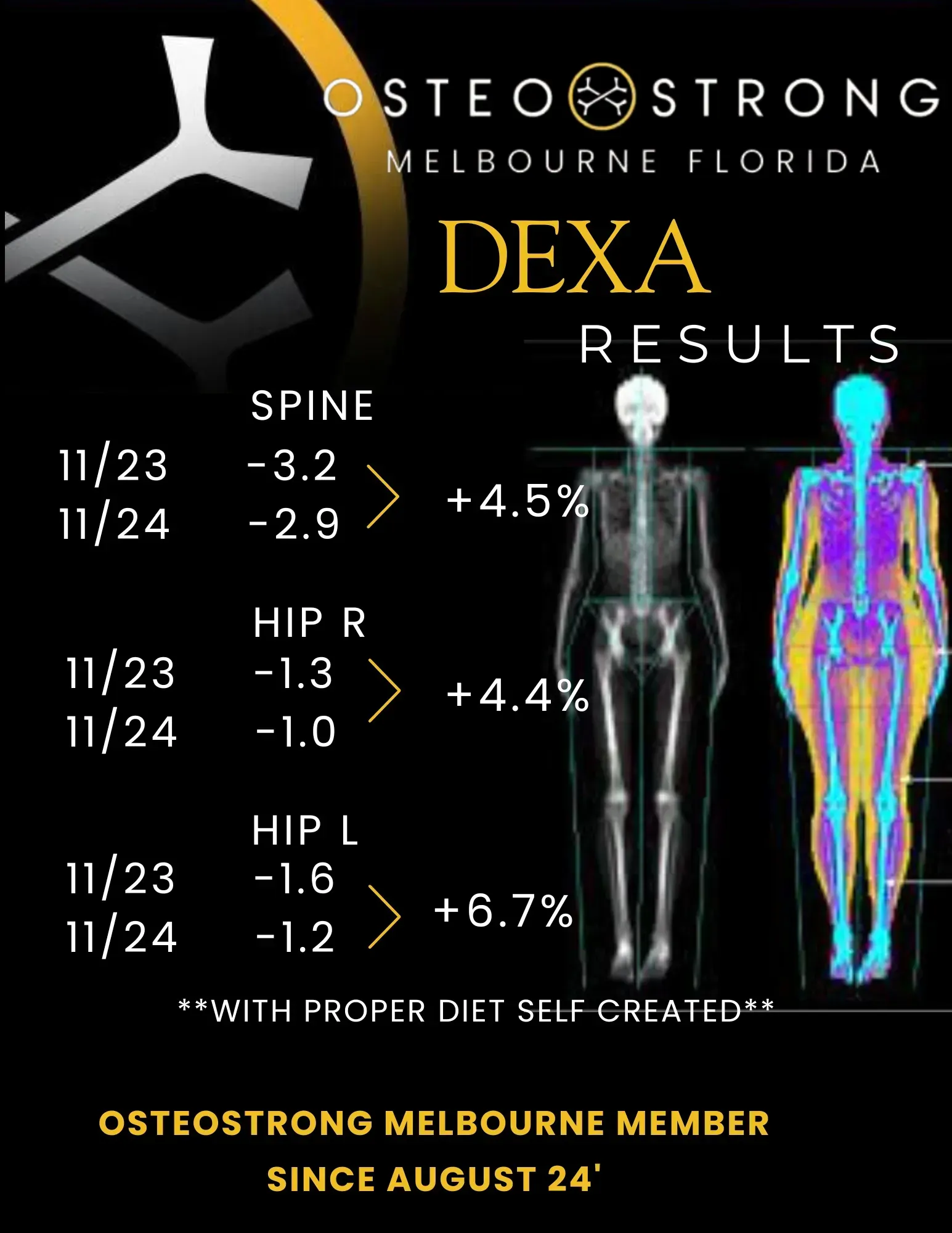 DEXA scan results poster showing spine, hip, and total body bone density changes with skeleton images and chart values