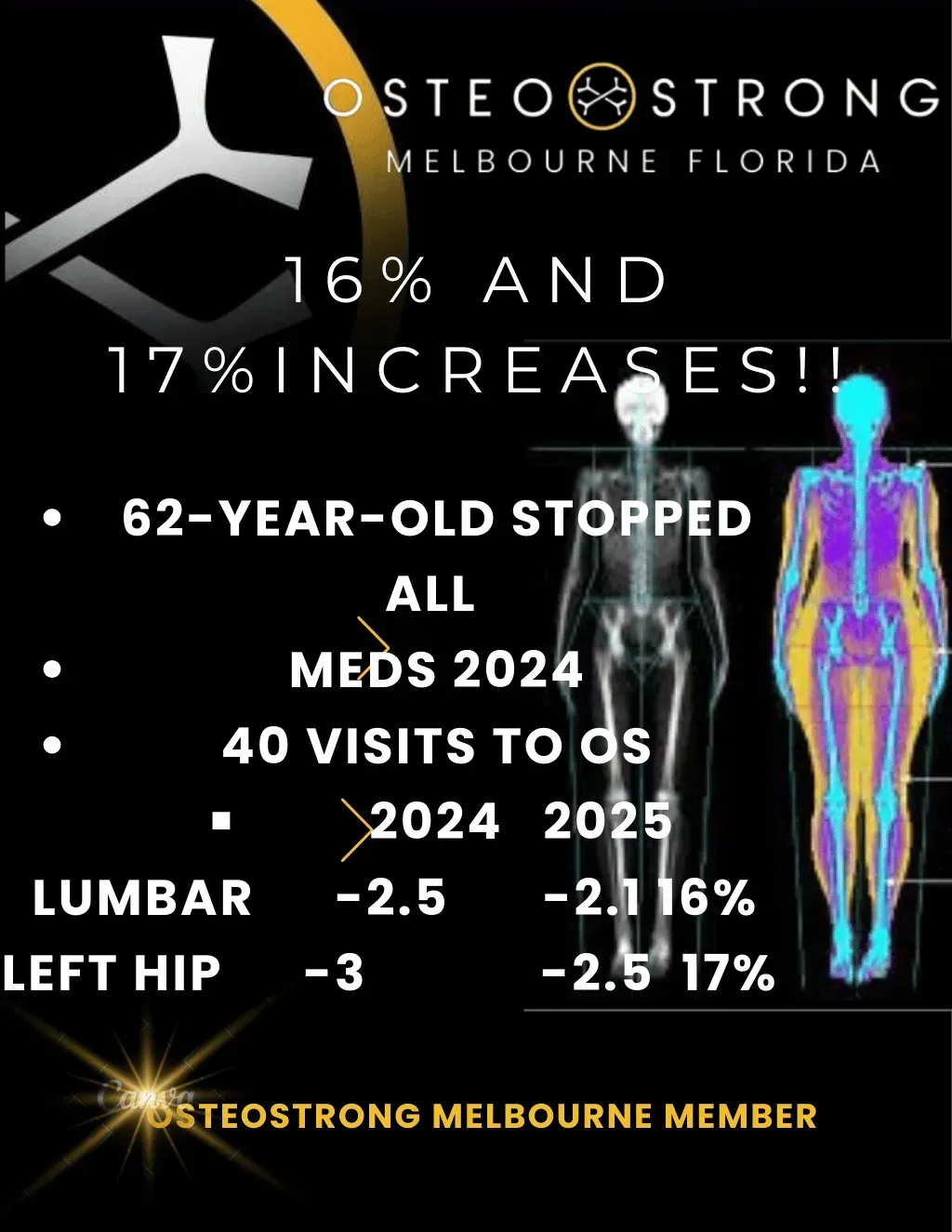 OsteoStrong Melbourne Florida ad showing 16% arm and 17% leg increase results with body scan graphic