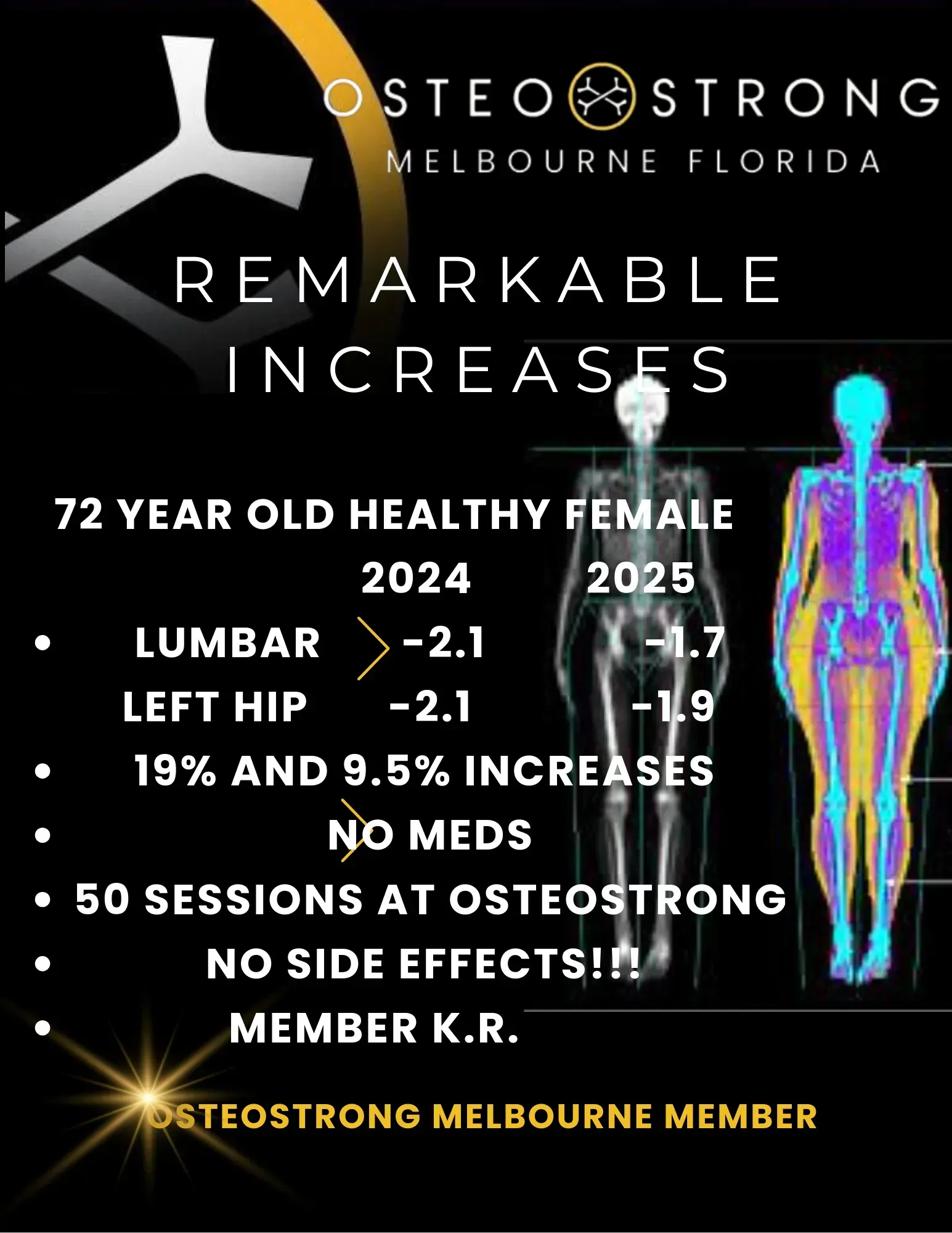 OsteoStrong poster showing remarkable bone density increases with colorful body scans and white text on black background