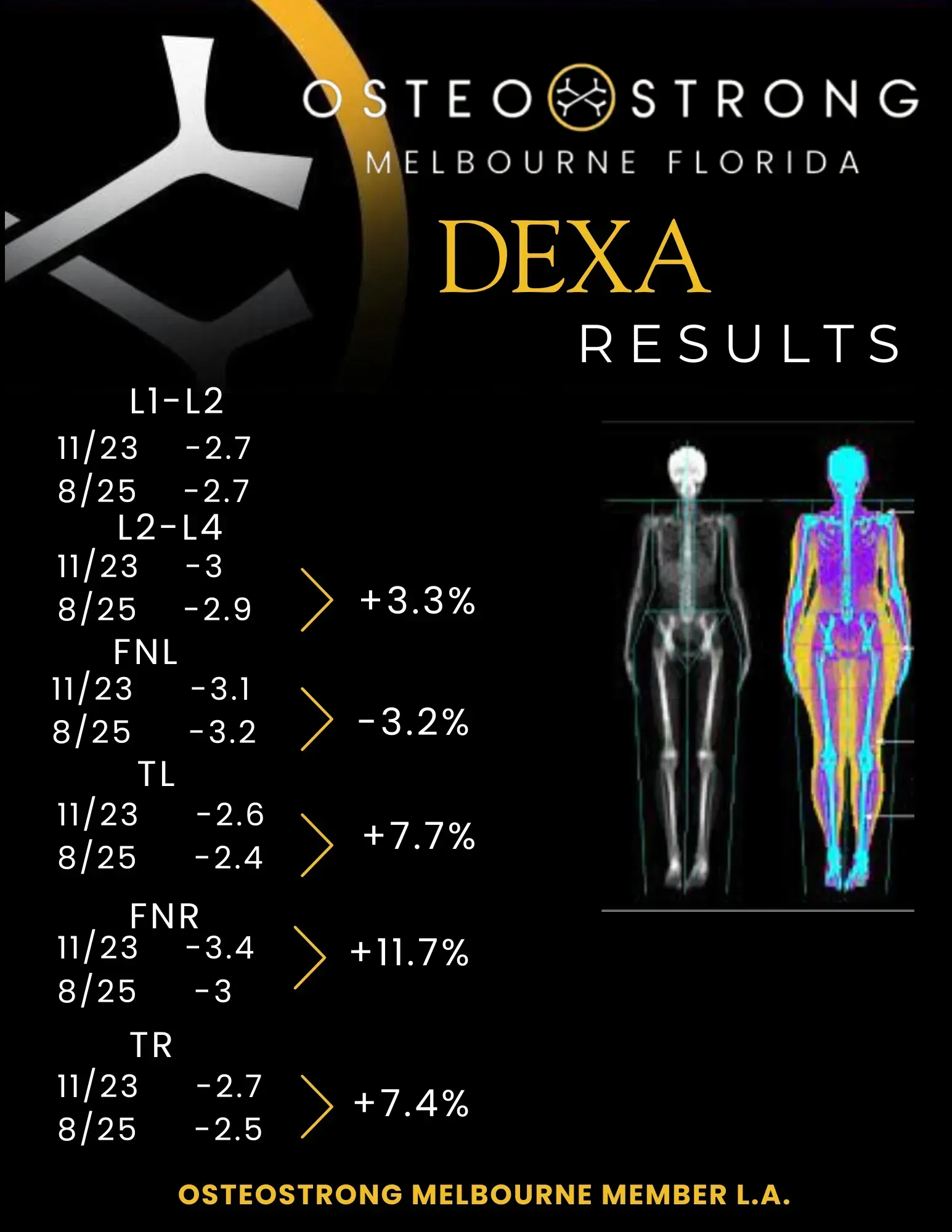 OsteoStrong Melbourne Florida DEXA results infographic with body scan images and bone score changes