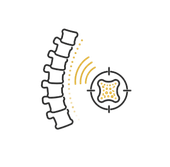 Spine vertebrae with yellow nerve signals pointing to a crosshair target on a disc or nerve center
