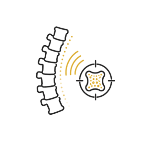 Spine vertebrae with yellow signal waves toward a crosshair target around a spinal cord cross-section