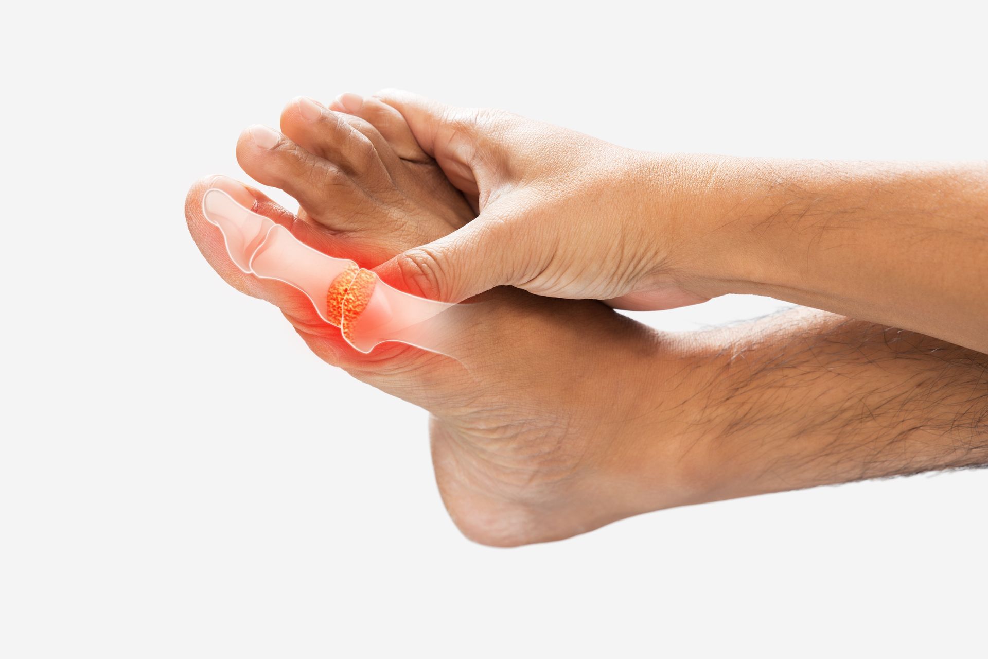 Foot with red highlight on big toe, being held by a hand; suggests pain.