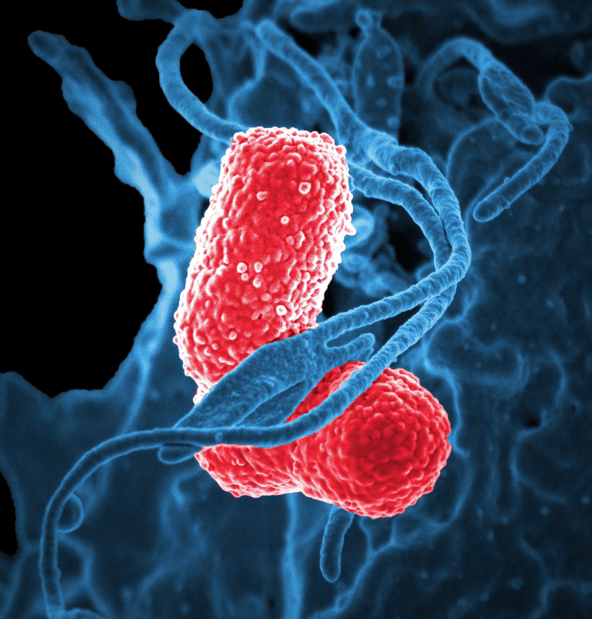 Bacteria and Viruses present in home water supplies can be harmful when consumed.