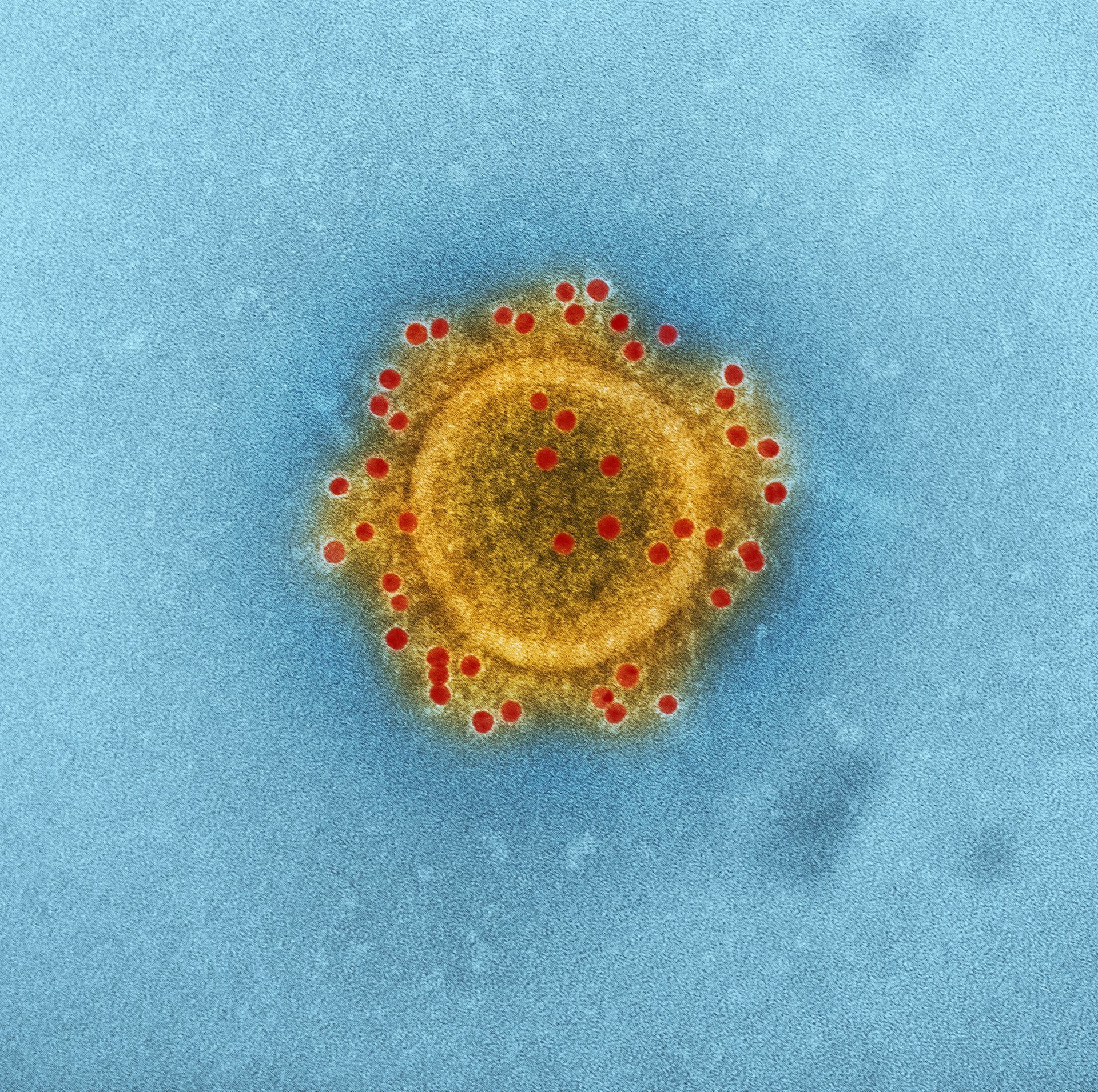 Bacteria and Viruses present in home water supplies can be harmful when consumed.