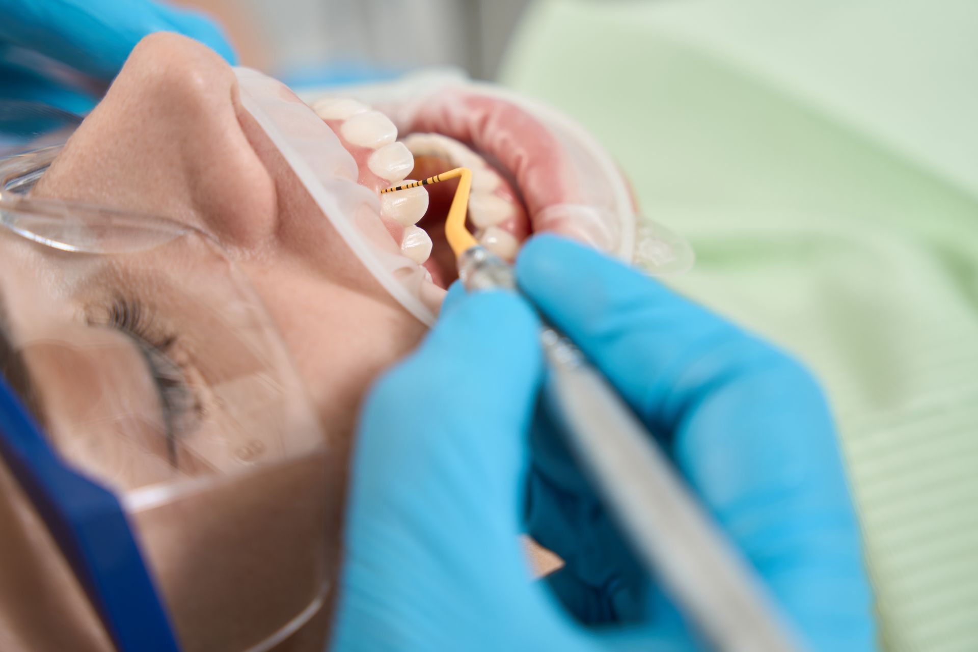 Experienced hygienist in nitrile gloves performing dental scaling on client.