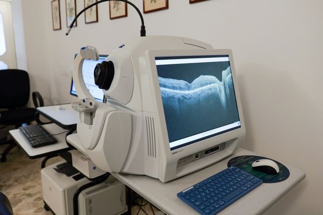 Apparecchio per tomografia a coerenza ottica in uno studio medico, con schermi di computer e due sgabelli regolabili.