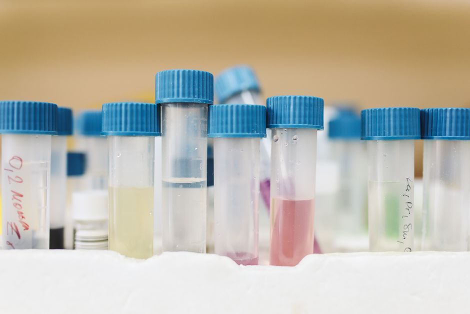 Test tubes in a medical laboratory