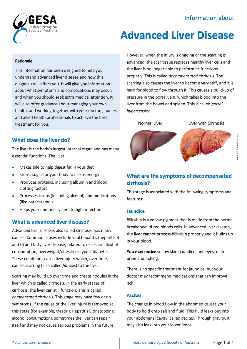 Advanced Liver Disease Sydney