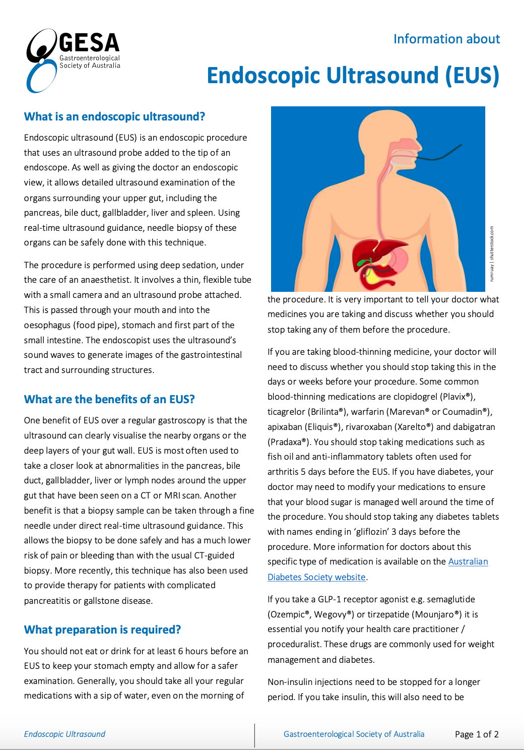 Endoscopic Ultrasound (EUS) Sydney
