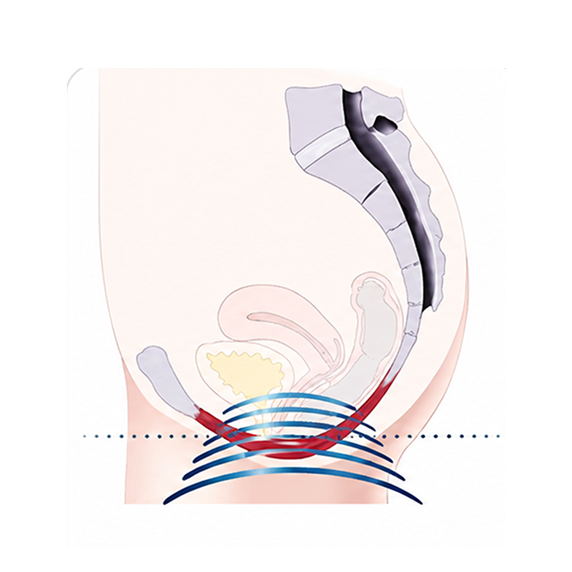 Cross-section diagram of pelvic floor anatomy with colored muscle layers and curved arrows showing movement.