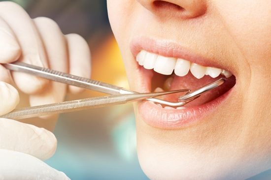 Faccette dentali