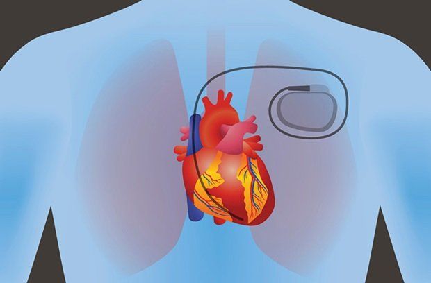 Cardiac device clinic in daytona beach and titusville