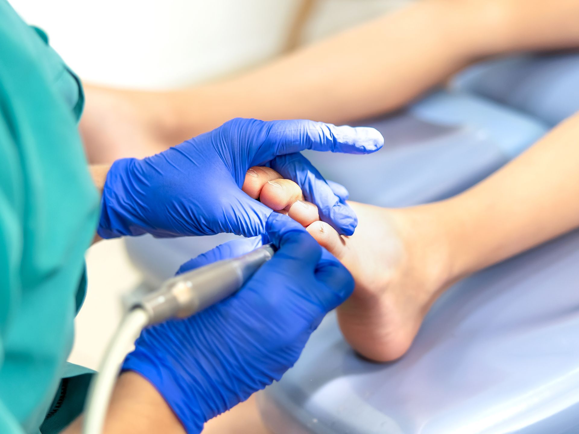 Person in blue gloves using a tool on a foot during a foot treatment.