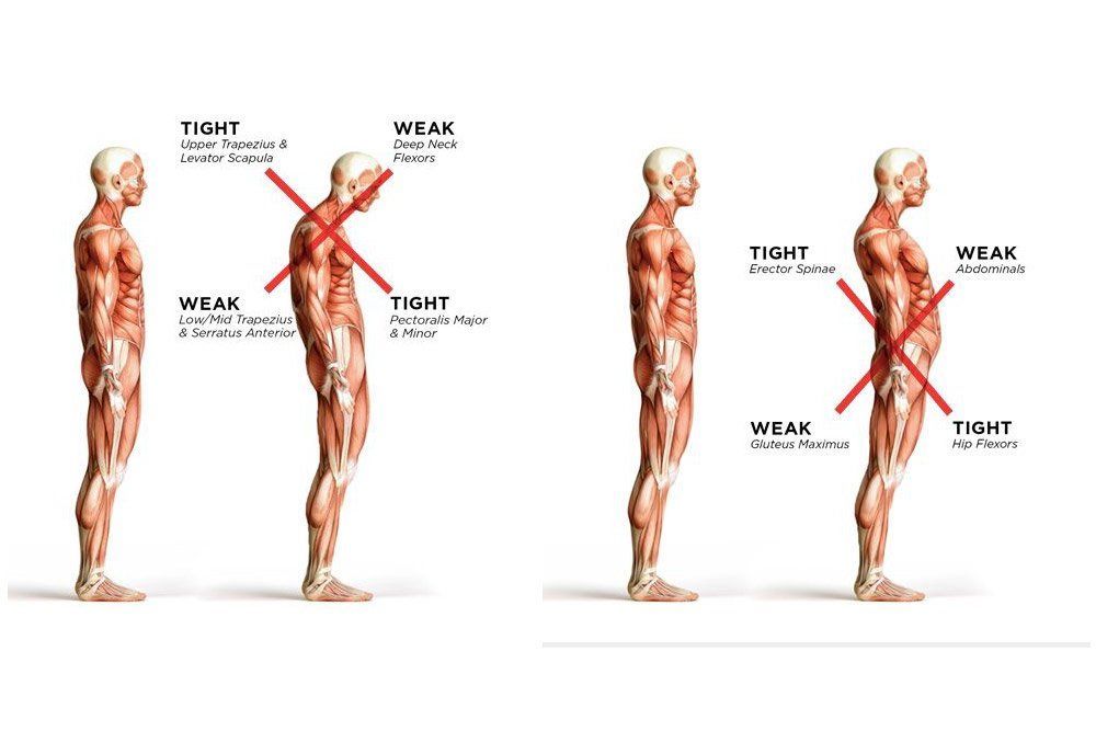 Side-view anatomy diagram comparing correct and incorrect standing posture with red alignment lines