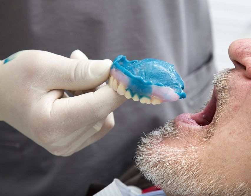 A man with a beard is getting dental work done by a dentist. — Port Denture Clinic In Port Macquarie, NSW