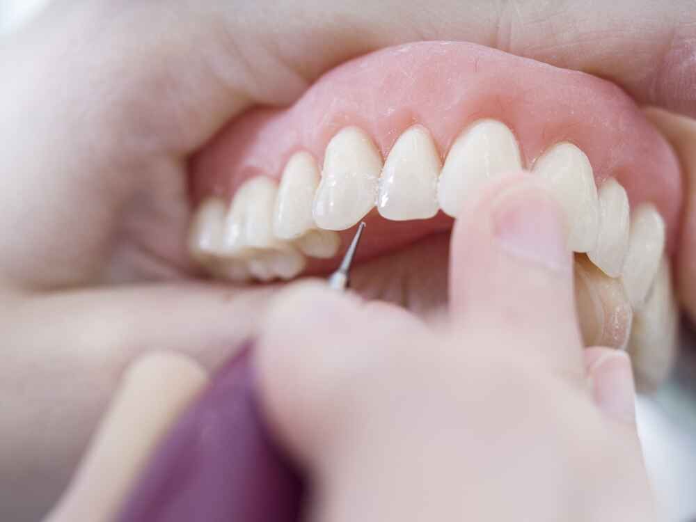 Dentures being worked on — Port Denture Clinic In Port Macquarie, NSW
