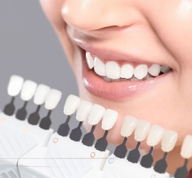 A Close Up Of A Woman 's Teeth With A Tooth Color Chart — Port Denture Clinic In Port Macquarie, NSW