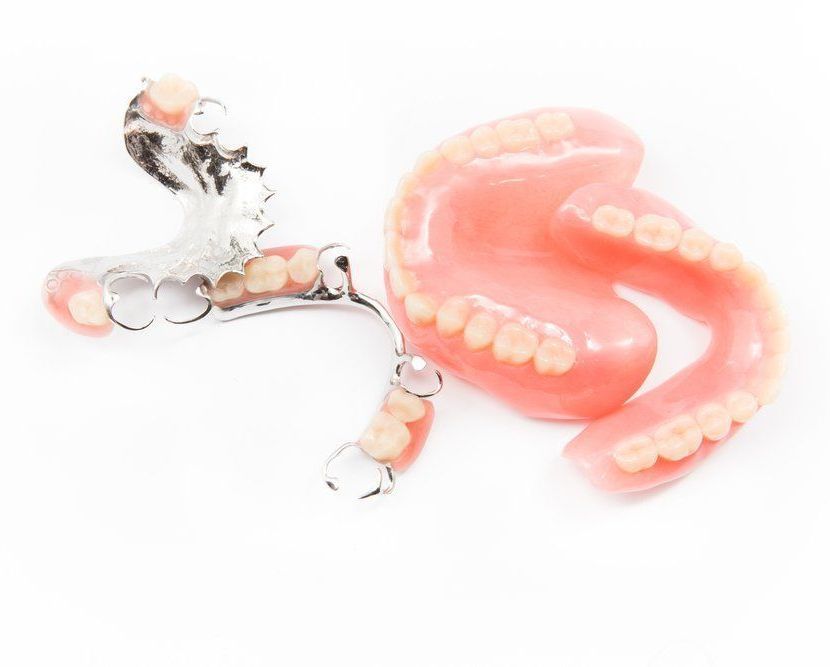 A Model of A Denture— Port Denture Clinic In Port Macquarie, NSW