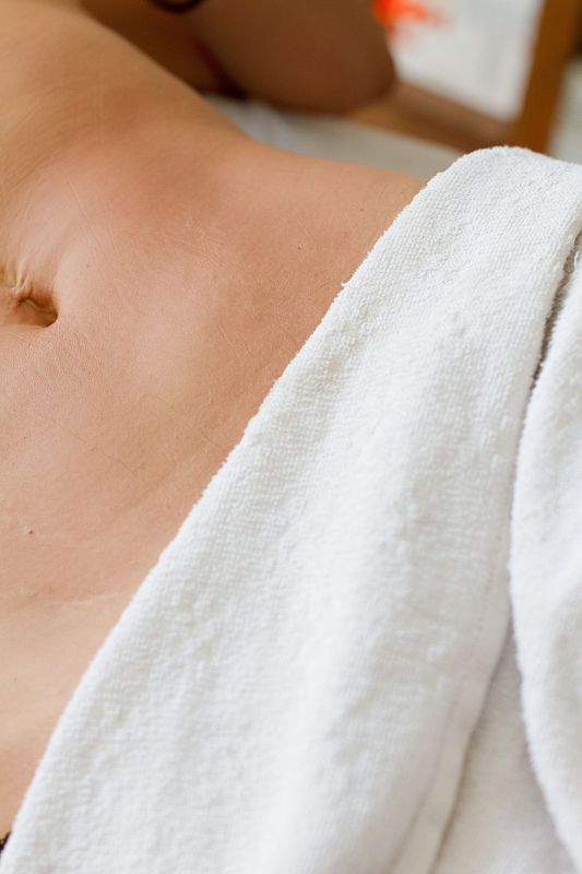 Primo piano della spalla nuda di una persona avvolta in un asciugamano bianco, su uno sfondo beige tenue.