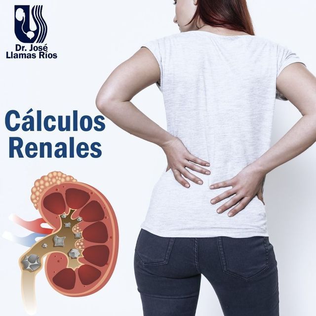 DR JOSÉ LLAMAS RÍOS URÓLOGO