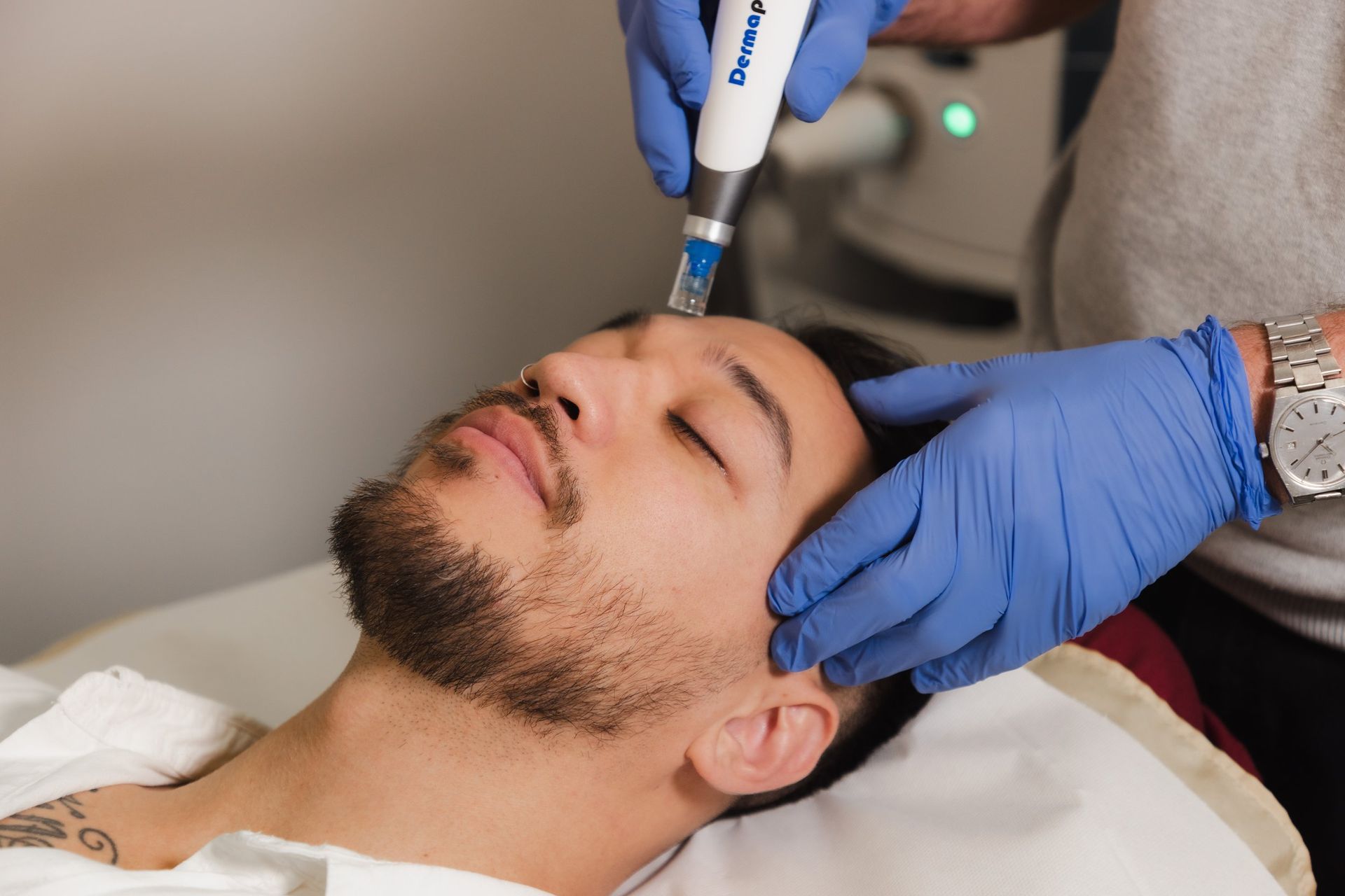 Micro Needling Newcastle | Cimed Cosmetic Medicine