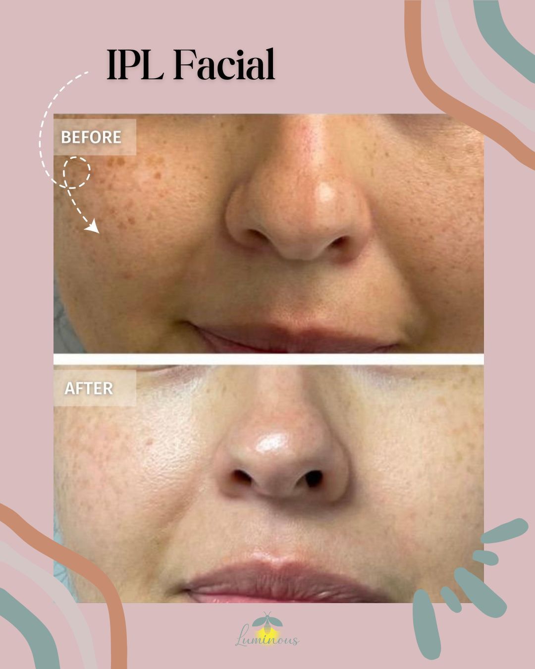 A before and after photo of a woman 's face