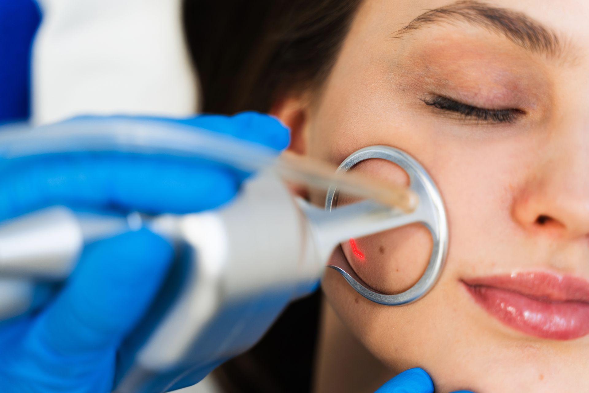 Gloved hand using a facial treatment device on a woman’s cheek, close-up skincare procedure