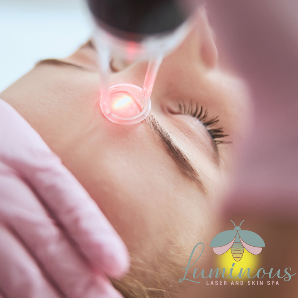 A woman is getting a laser treatment on her face.