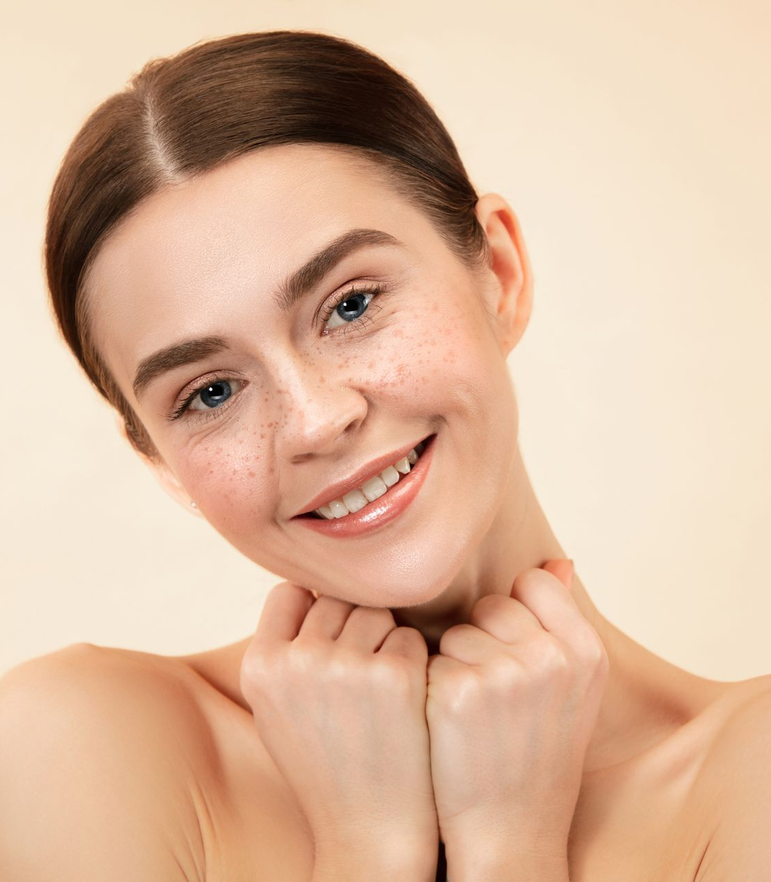 Smiling person with freckles, hands under chin, against a soft beige background