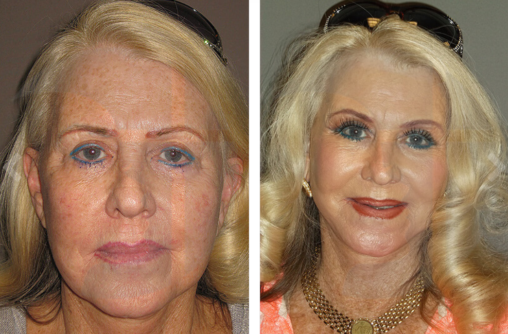 Before and after portraits of a woman, with makeup in the second photo.
