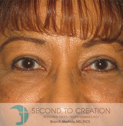 Close-up of eyes, wrinkles, and eyebrows. The logo