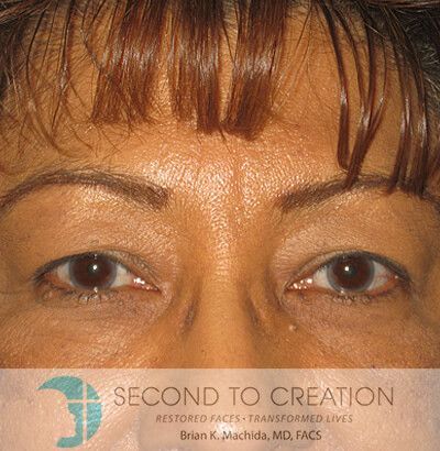 Close-up of eyes, with brown hair and bangs; a