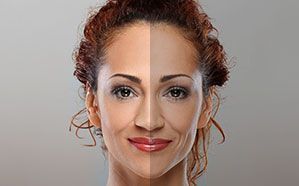 Woman's face split vertically; left side tanned, right side lighter, showing skin differences.