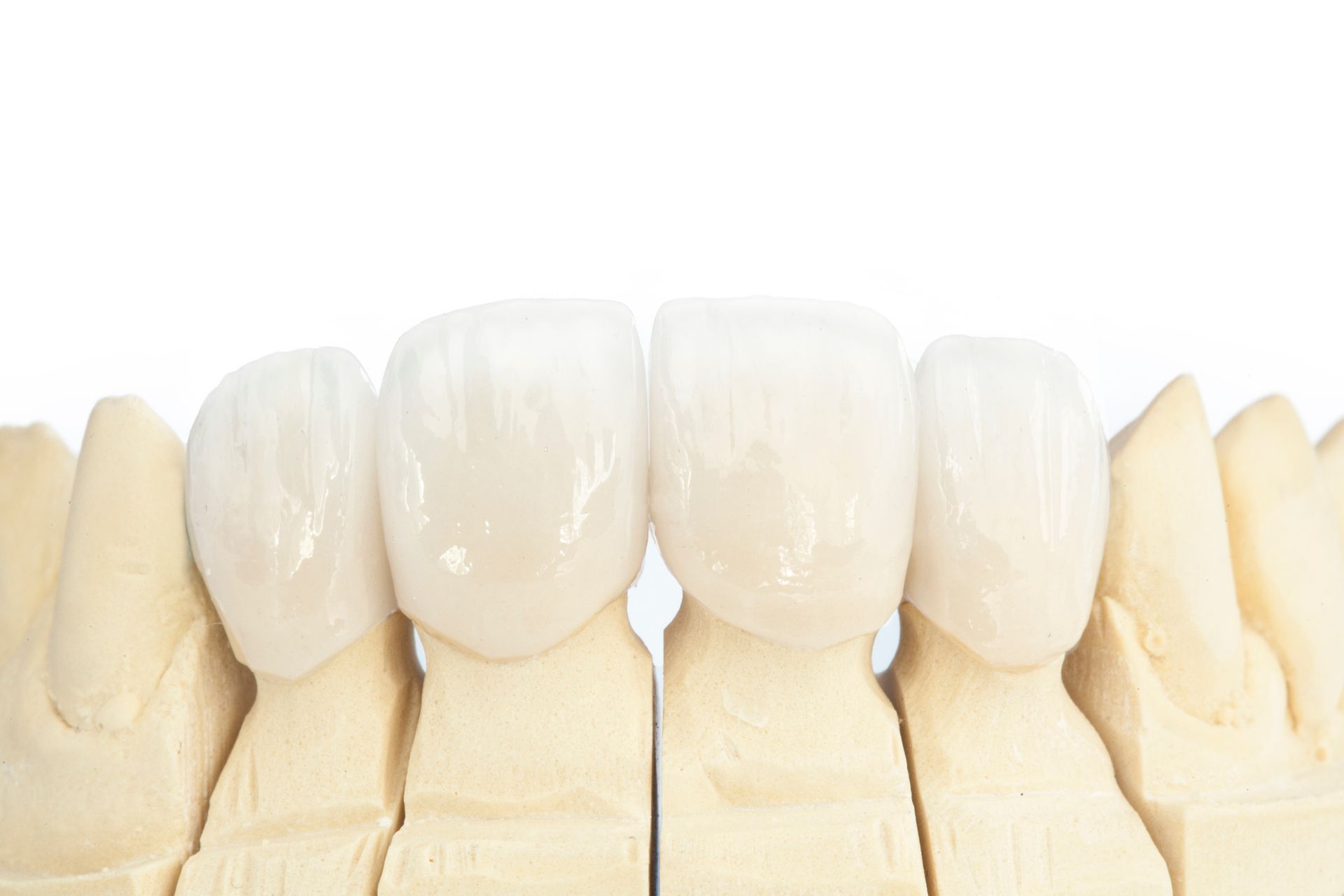 Dental Implants Minneapolis