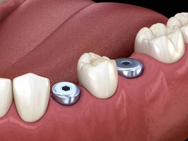 Facial Aesthetics Minneapolis